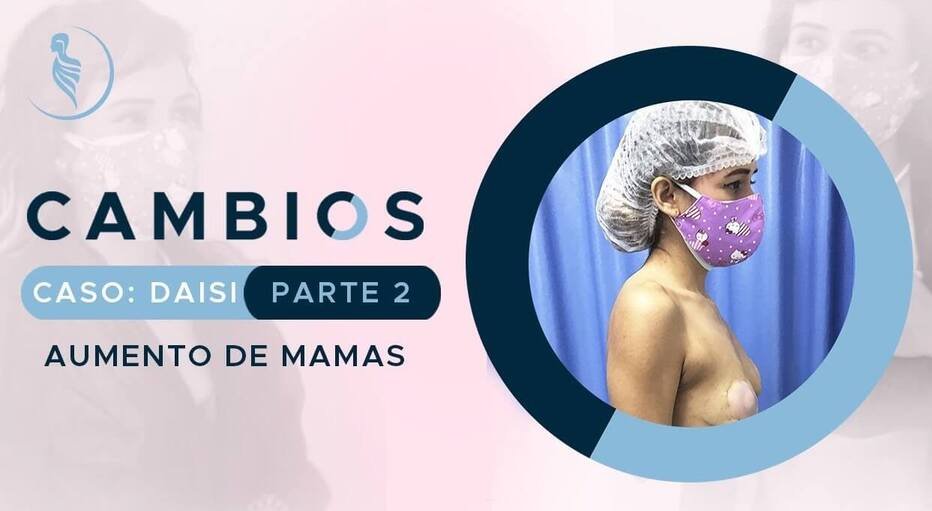 caratula video caso de éxito