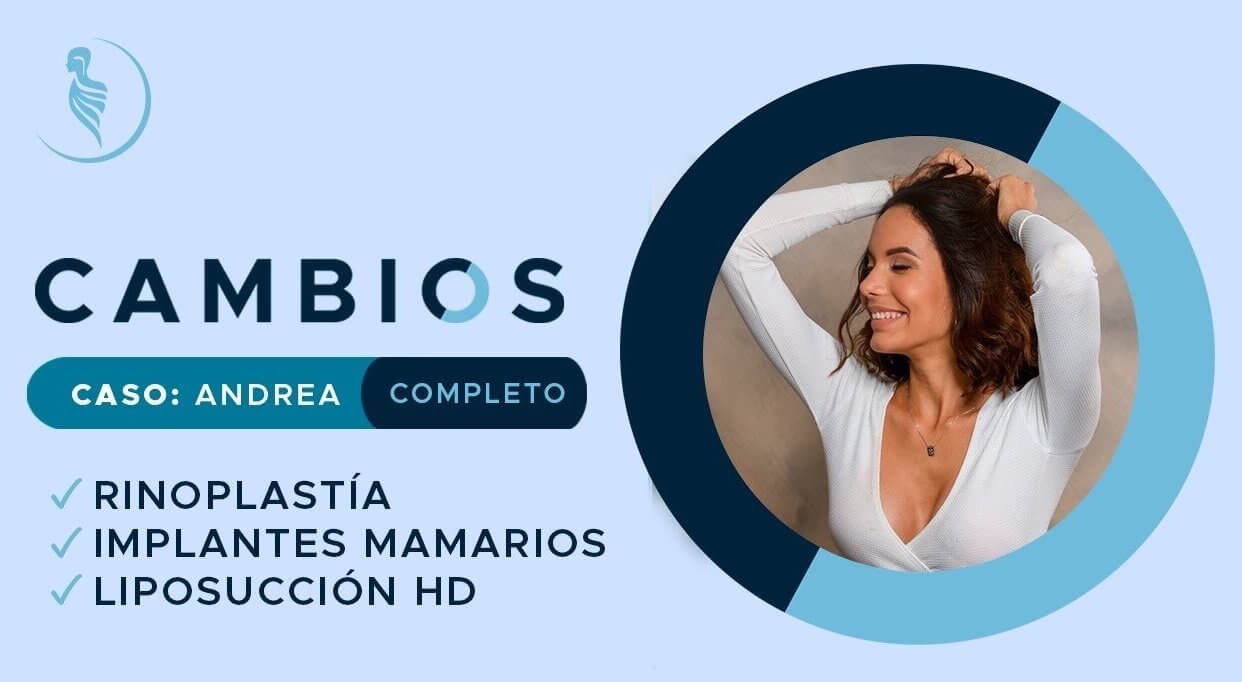 caratula video caso de éxito