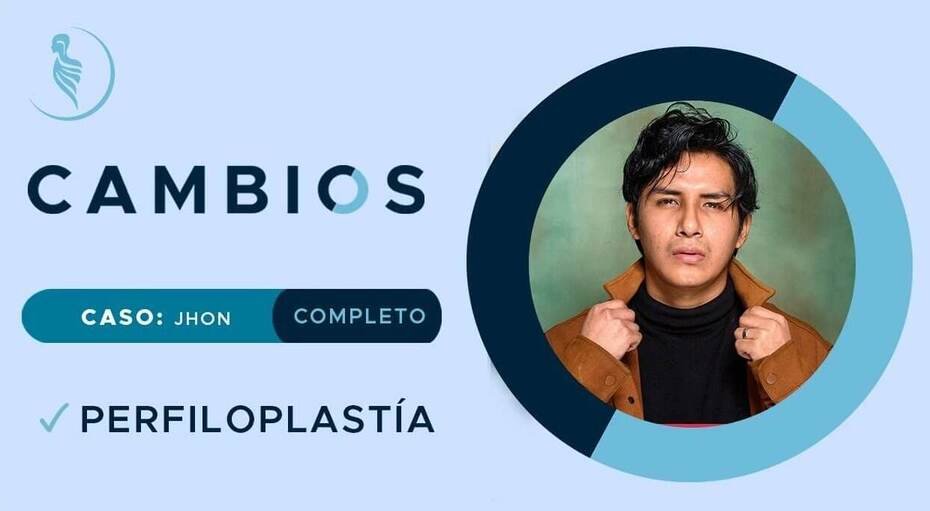 caratula video caso de éxito