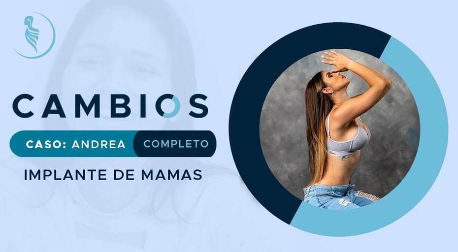 caratula video caso de éxito