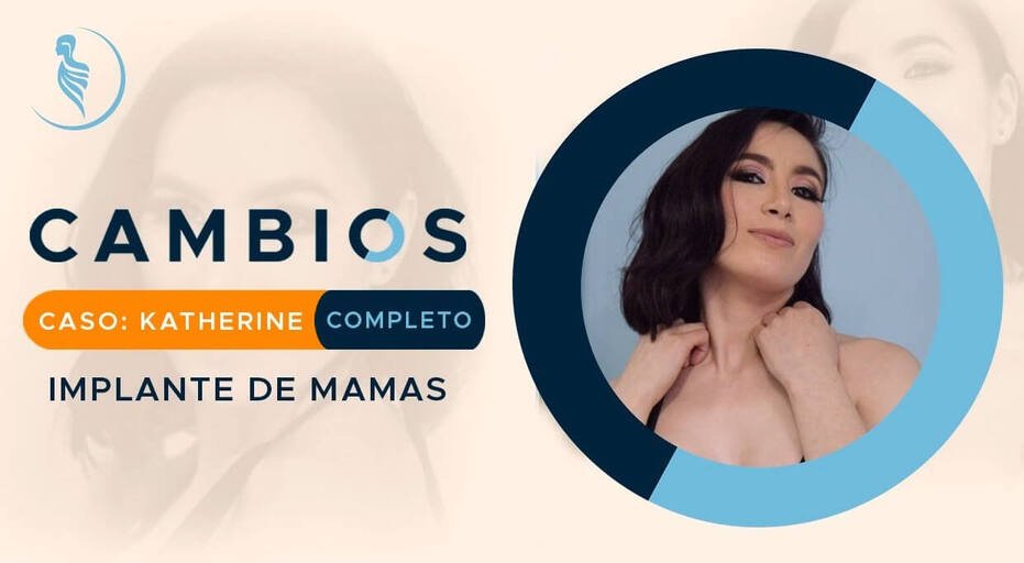 caratula video caso de éxito