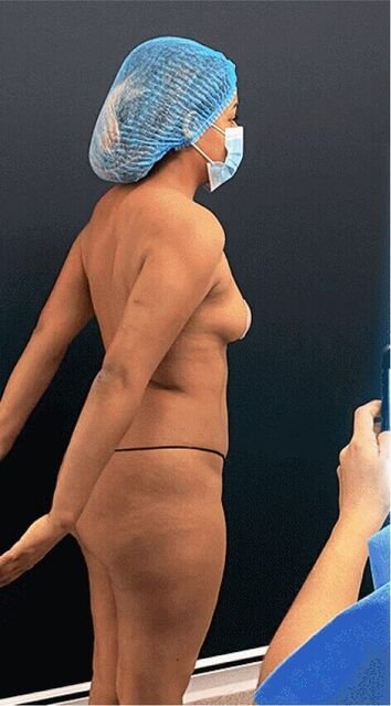 imagen Karen pre operatorio