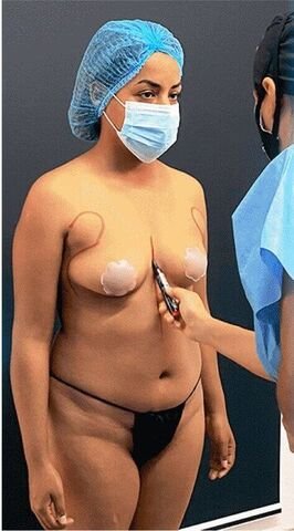 imagen Karen pre operatorio