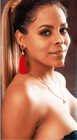 imagen Karen post operatorio