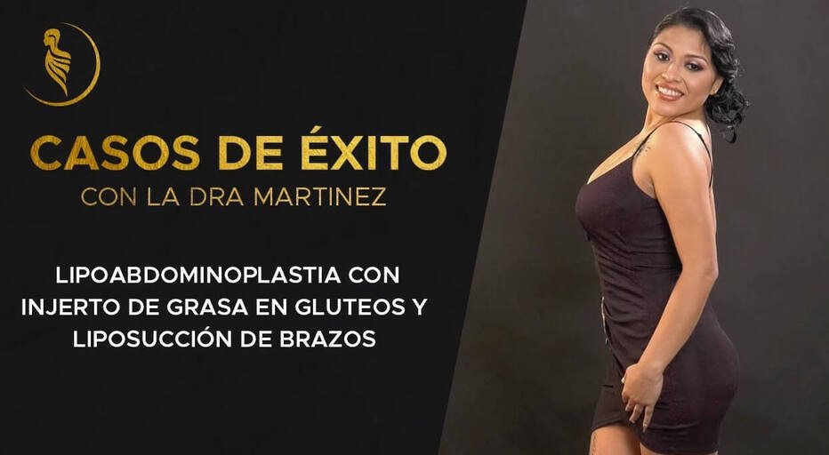 caratula video caso de éxito