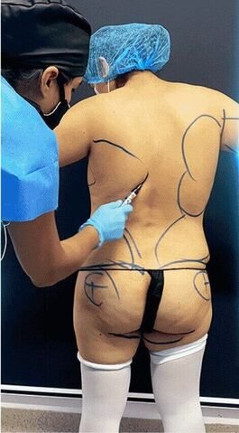 imagen Luz pre operatorio